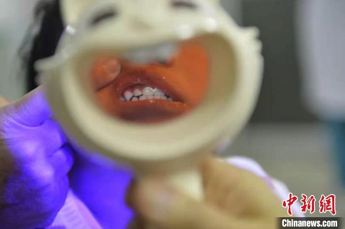 ����ͼ��ҽ��Ϊ��ͯ���п�ǻ��顣������ ��